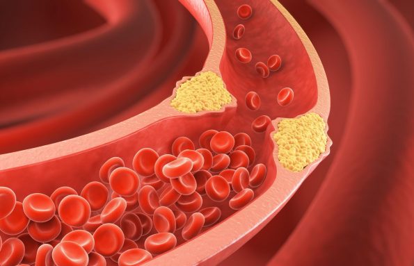Heart Health 101: Understanding Cholesterol’s Role in Your Body